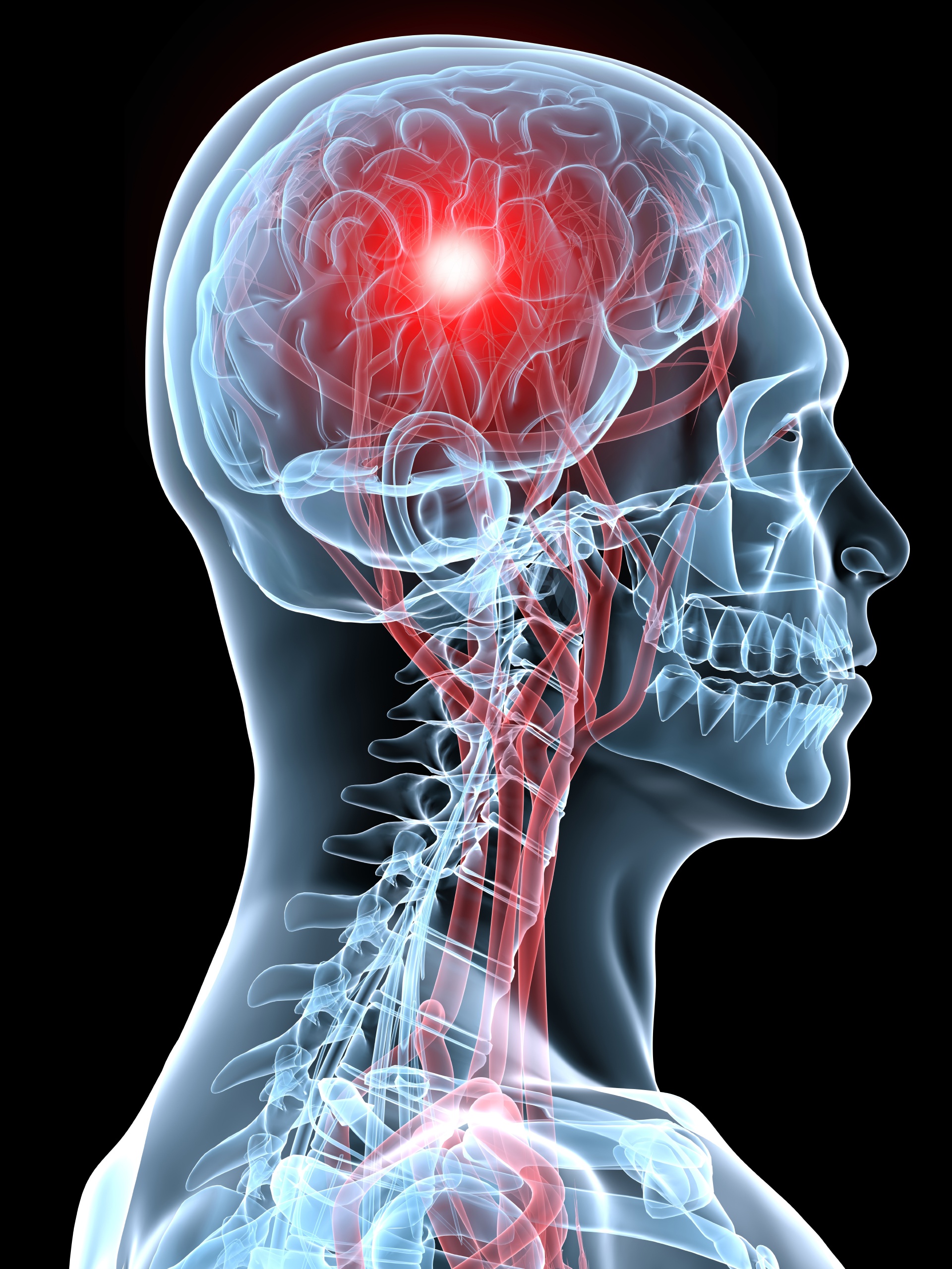 photo of brain