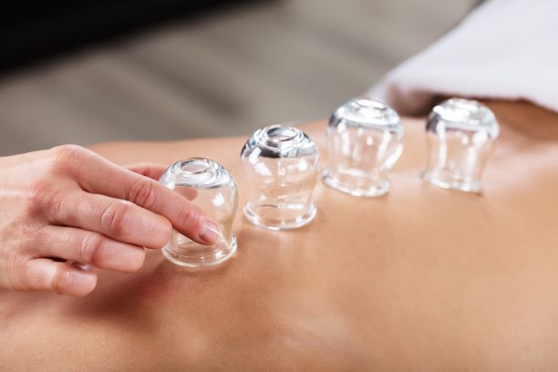 Therapeutic Cupping for Health Professionals